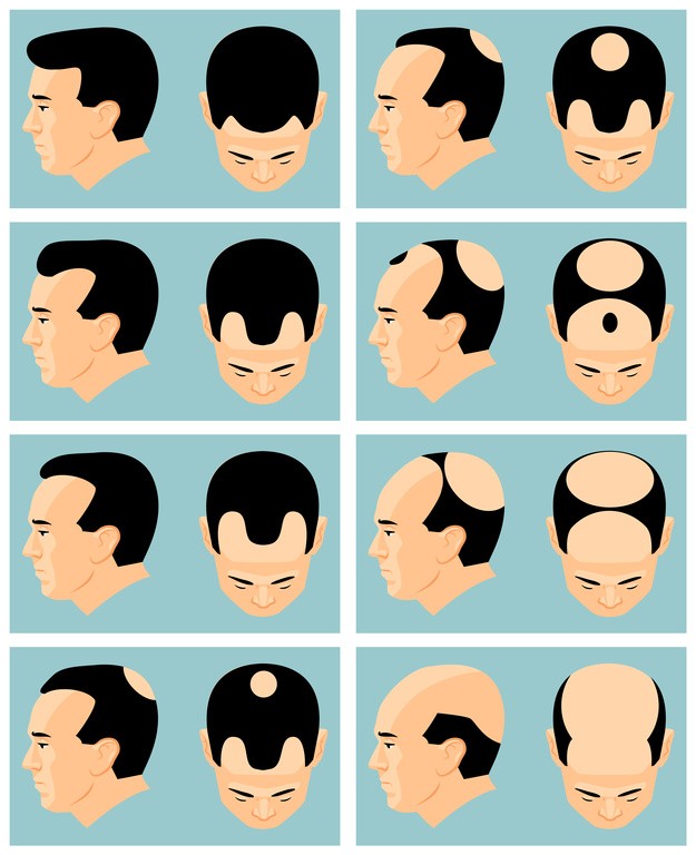 Pigmentazione capelli Pigmentazione capelli - Pigmentazione capelli