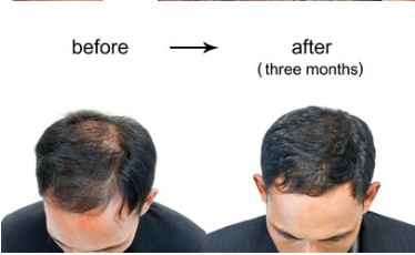 Tatuaggio capelli