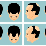 tricopigmentazione capelli